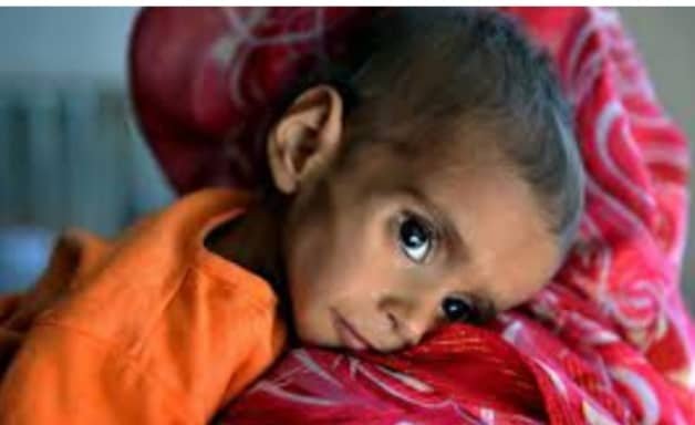 UNICEF: Nearly 900,000 children in Afghanistan suffer from fatal malnutrition